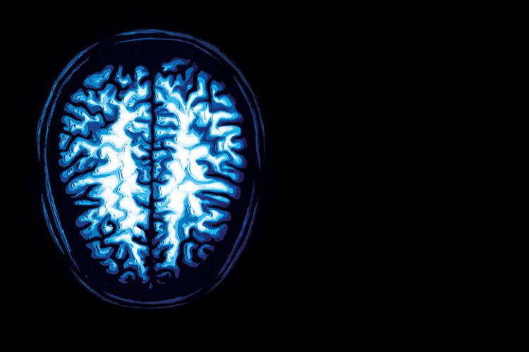 Brain scan imagery from the Times Higher Education article on PMU's AI research against brain cancer